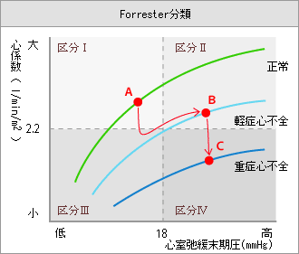 Forrester